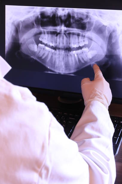 Best Emergency Dental Care for Trauma or Injury in Burnt Mills, MD