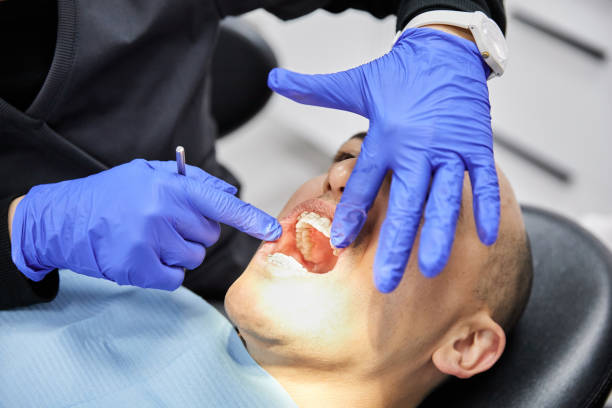 Best Emergency Tooth Extraction in Burnt Mills, MD